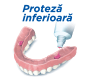 proteza dentară inferioară cum se aplică crema adezivă pe proteza dentară înferioară